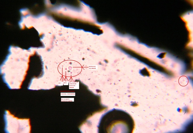 Человеческая кровь состоит на 94,2% из красных кровяных телец или эритроцитов, на 0,13% из белых кровяных телец или лейкоцитов, и на 5,65% из тромбоцитов. На следующих изображениях приведены очень странные данные: согласно этим материалам, в угле и в марсианском метеорите NWA998 были найдены останки белых, а также красных кровяных телец.